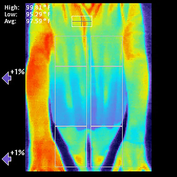 Thermografische Aufnahme des unteren Rückens mit markierten Messbereichen