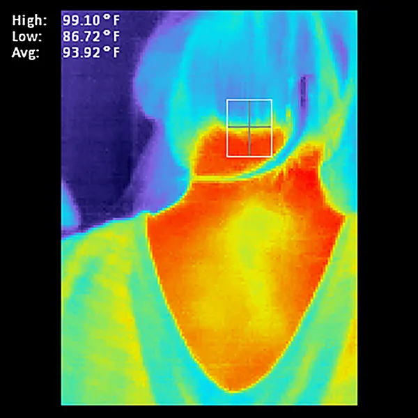 Thermografische Aufnahme des Nacken- und oberen Rückenbereichs mit farbiger Temperaturdarstellung