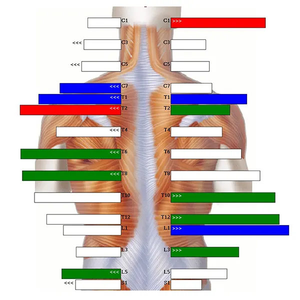 Chiropraktik Wirbelsäulen Thermal-Scan