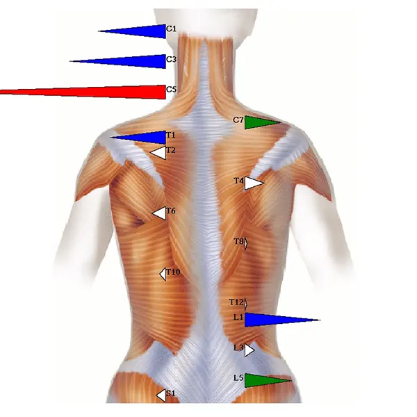 Chiropraktik Wirbelsäulen Thermal-Scan