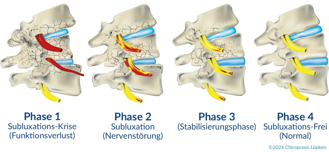 Die vier Phasen Heilung der Chiropraktik
